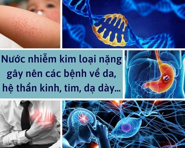 nước kim loại nặng gây bệnh về da, thần kinh, dạ dày
